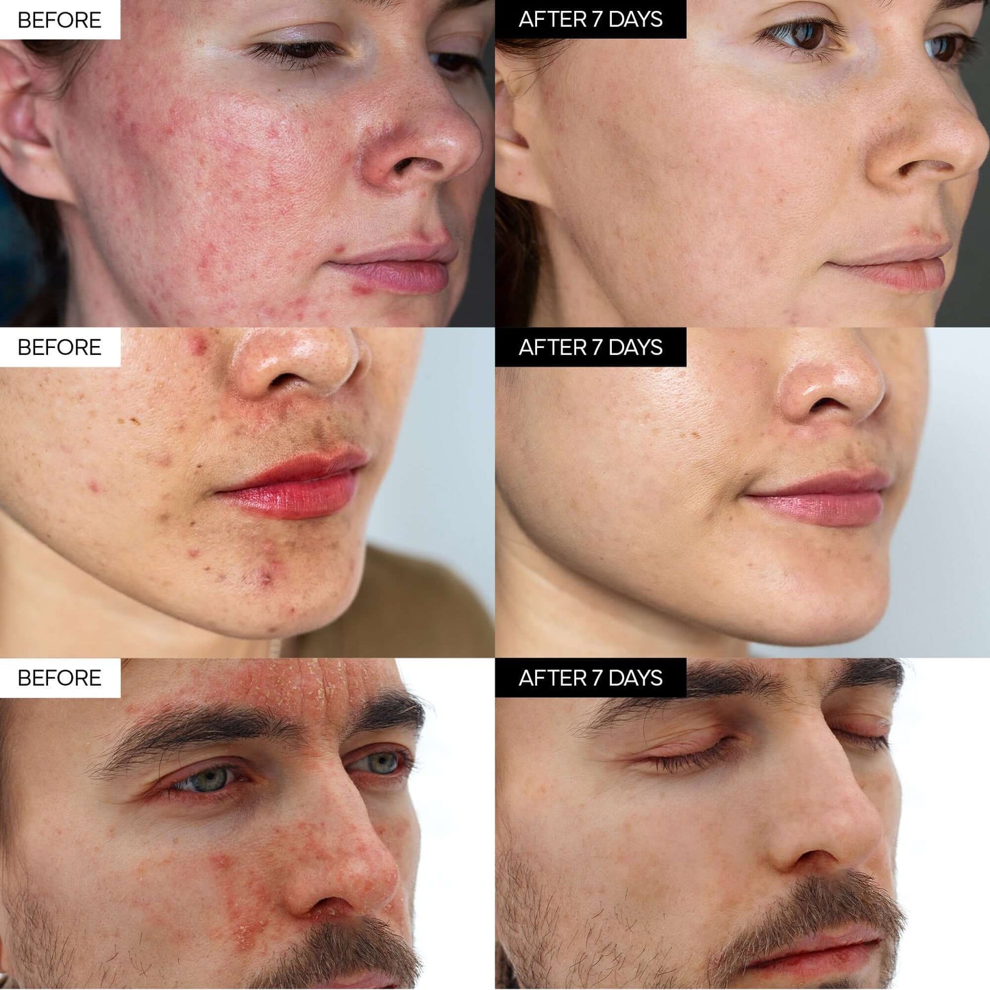 Skavix™ Intensive Cica Repair Cream