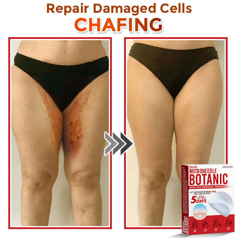 Divifit MicroNeedle Botanic Skin Tag Removal Patch 🇺🇸 Made in the USA