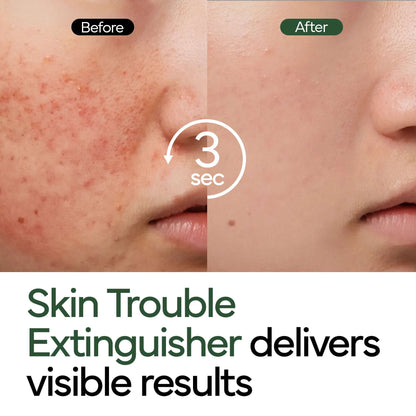 Skavix™ Intensive Cica Repair Cream