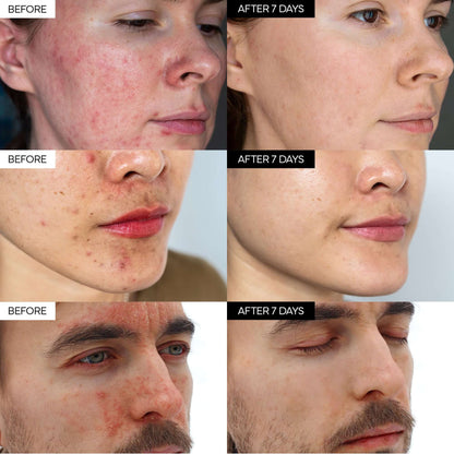 Skavix™ Intensive Cica Repair Cream