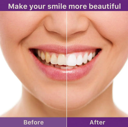 Final 3 Hours: 60%OFF🔥Teeth Whitening Powder & Vegan Powder - Peroxide-Free, Removes Stains - Daily Brightening Formula