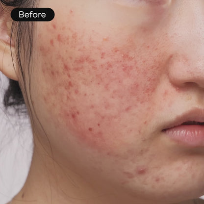 Skavix™ Intensive Cica Repair Cream